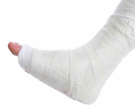Employer Achilles’ Heel—Supervisor Failure to Enforce OSHA Compliance