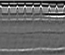 GPR Talk: But Wait, There’s More!